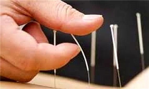 طب سوزنی می تواند به پیشگیری از دیابت کمک کند؟