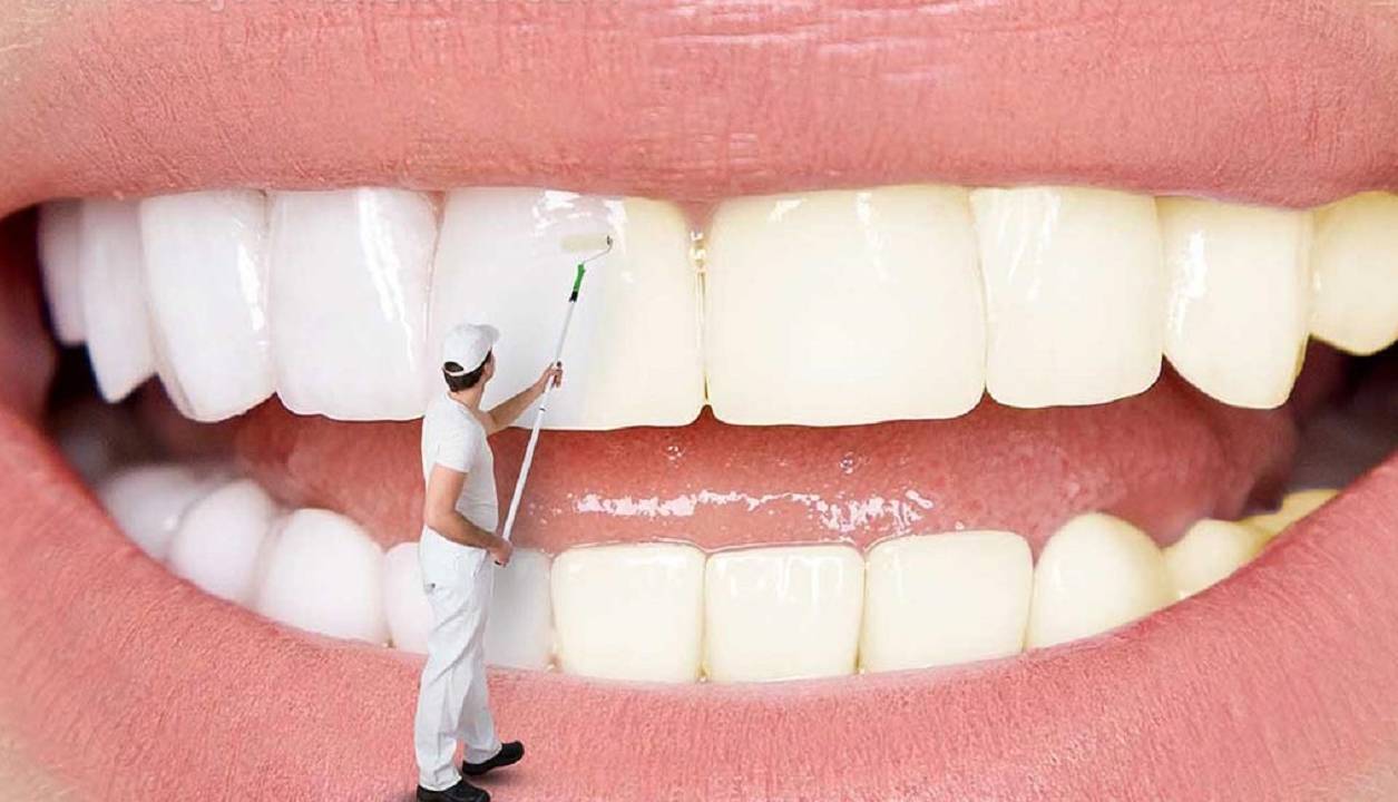 جرم دندان؛ نقش‌ منفی‌های دهان