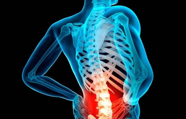 سریع ترین روش تشخیص دیسک کمر!