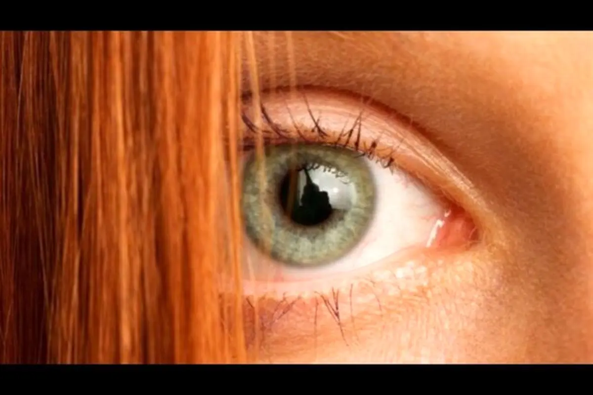 دلیل بهبود نیافتن برخی زخم‌ها در ژن موی قرمز نهفته است