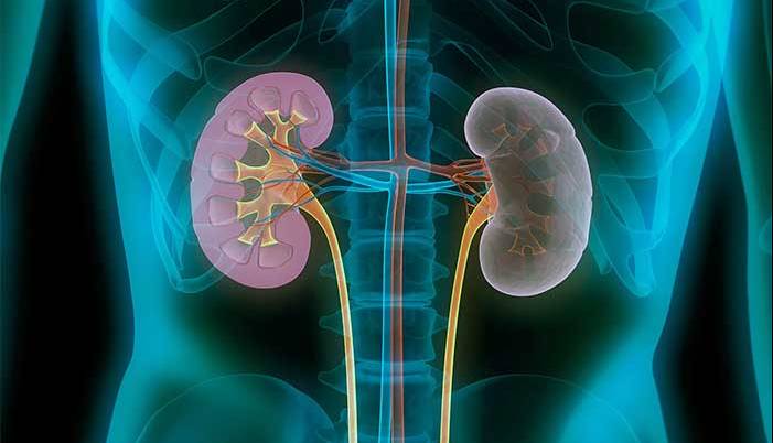 راه‌ و رسم سلامت برای بیماران کلیوی