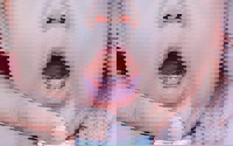 دندان درآوردن کودک ربطی به اسهال ندارد!