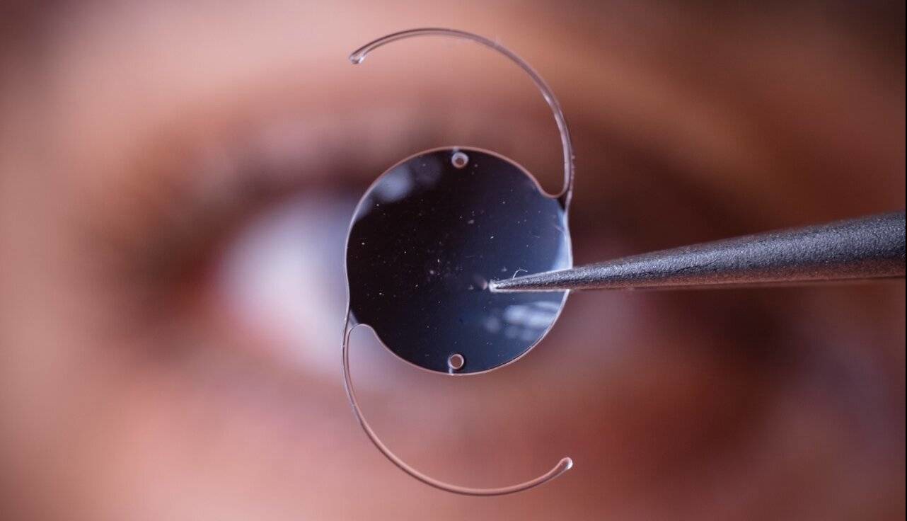 سبک زندگی نادرست، سن ابتلا به آب‌مروارید را پایین آورد