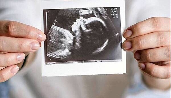 اهمیت تشخیص زودهنگام بیماری‌های قلبی در بارداری