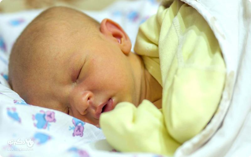 نحوه تشخیص زردی در نوزادان