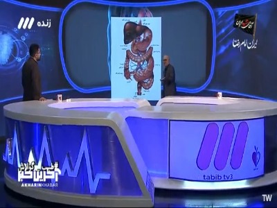 یک بیماری بسیار مهم گوارشی