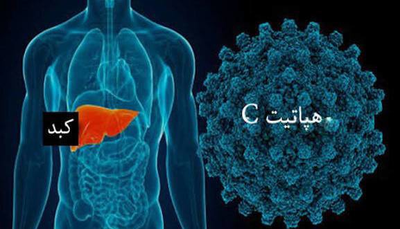 هپاتیت C بیماری خاموش بدون واکسن اما قابل درمان | آخرین خبر