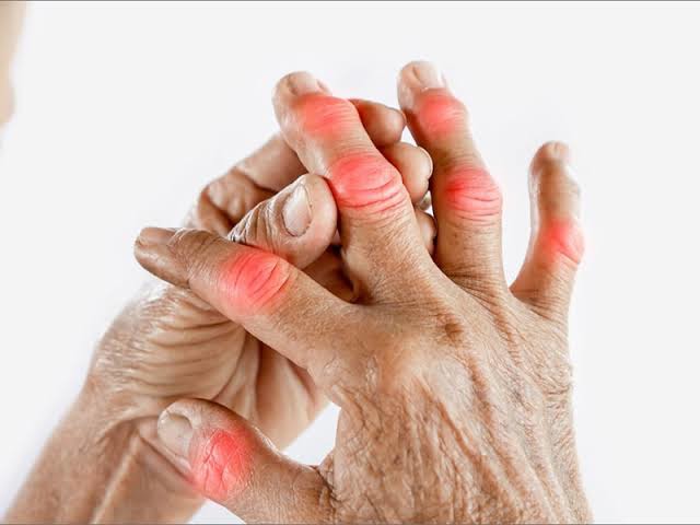 بیماری روماتیسم ارثی است؟