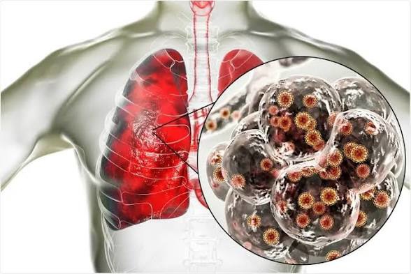 آیا ویروس کرونا خودش را با بدن انسان سازگار کرده است؟